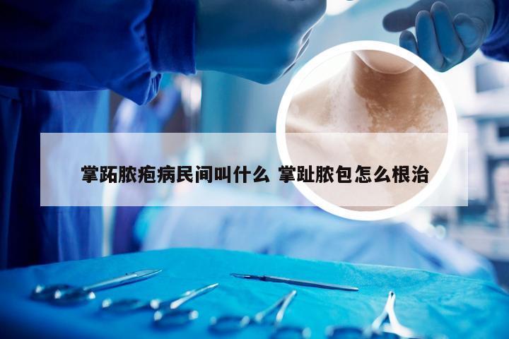 掌跖脓疱病民间叫什么 掌趾脓包怎么根治