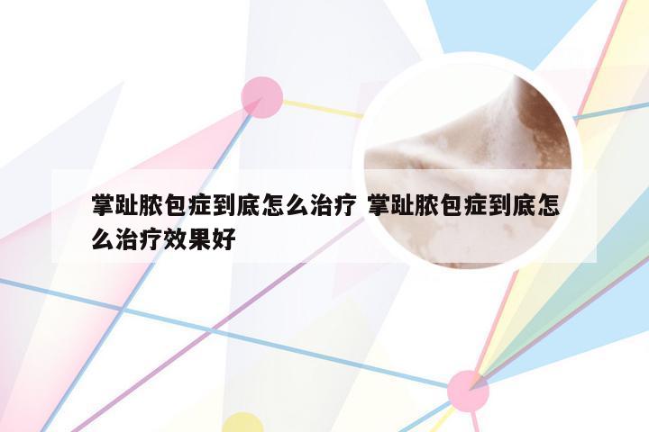 掌趾脓包症到底怎么治疗 掌趾脓包症到底怎么治疗效果好