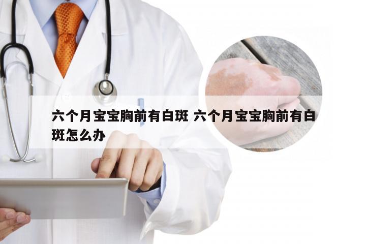 六个月宝宝胸前有白斑 六个月宝宝胸前有白斑怎么办