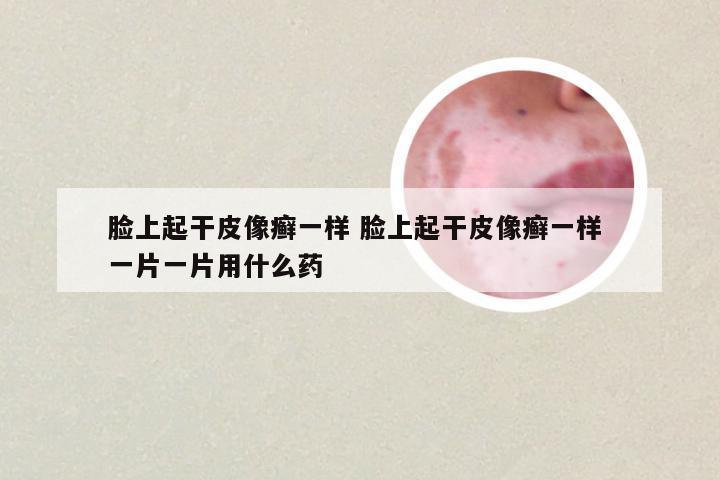 脸上起干皮像癣一样 脸上起干皮像癣一样 一片一片用什么药