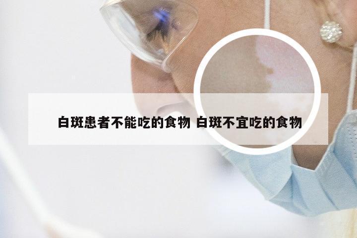 白斑患者不能吃的食物 白斑不宜吃的食物