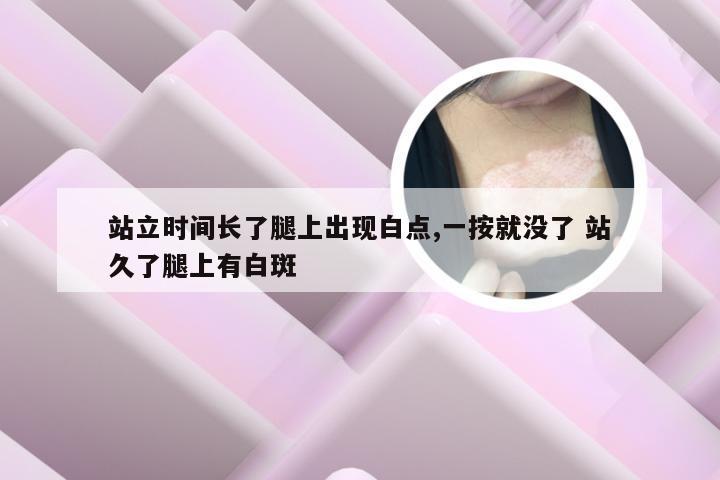 站立时间长了腿上出现白点,一按就没了 站久了腿上有白斑