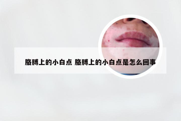 胳膊上的小白点 胳膊上的小白点是怎么回事