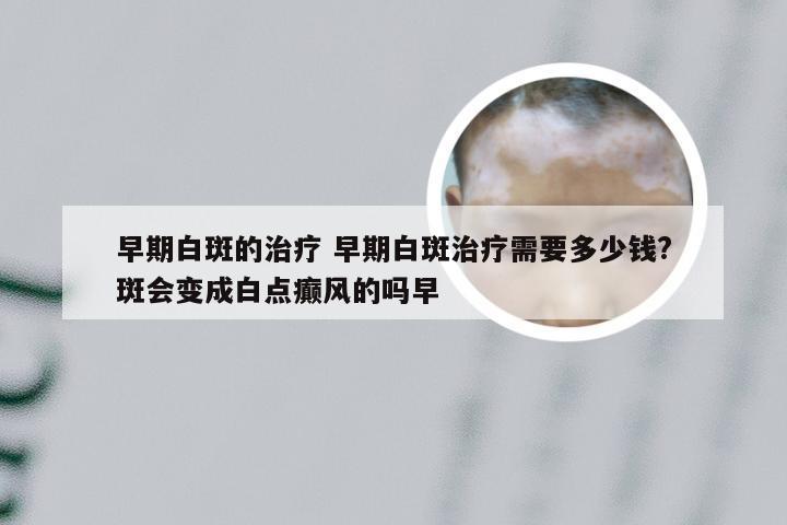 早期白斑的治疗 早期白斑治疗需要多少钱?斑会变成白点癫风的吗早