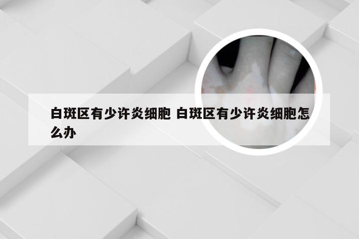 白斑区有少许炎细胞 白斑区有少许炎细胞怎么办
