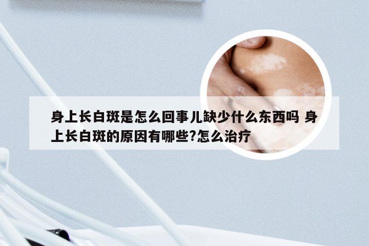 身上长白斑是怎么回事儿缺少什么东西吗 身上长白斑的原因有哪些?怎么治疗
