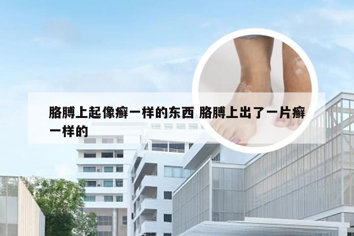 胳膊上起像癣一样的东西 胳膊上出了一片癣一样的