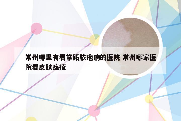 常州哪里有看掌跖脓疱病的医院 常州哪家医院看皮肤痤疮