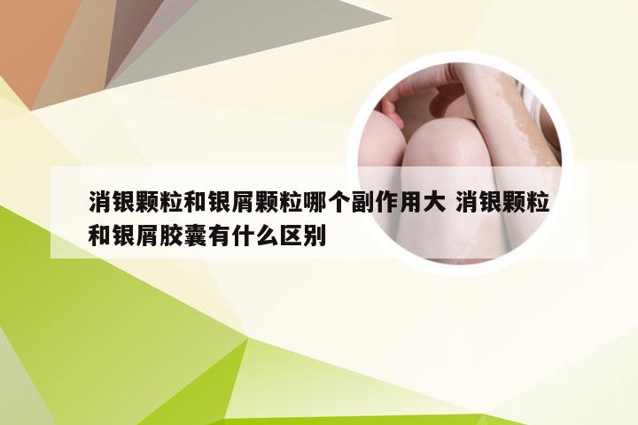消银颗粒和银屑颗粒哪个副作用大 消银颗粒和银屑胶囊有什么区别