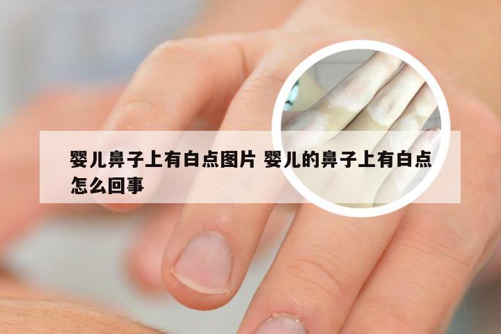 婴儿鼻子上有白点图片 婴儿的鼻子上有白点怎么回事