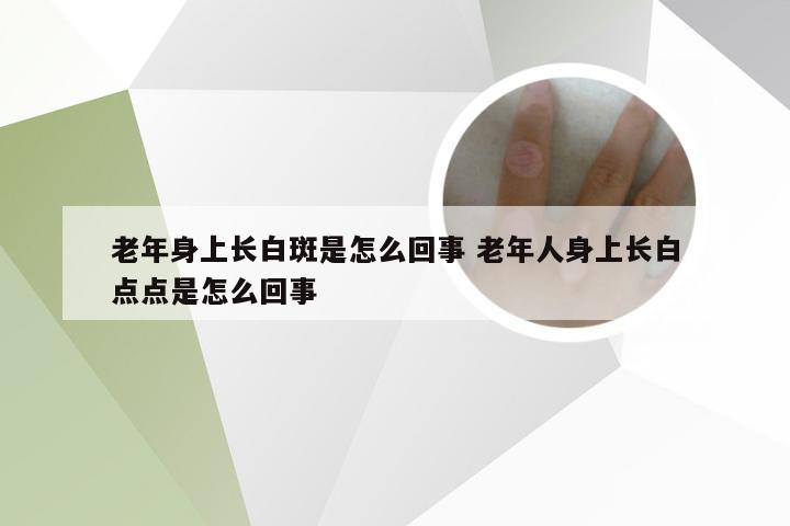 老年身上长白斑是怎么回事 老年人身上长白点点是怎么回事