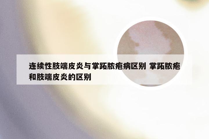 连续性肢端皮炎与掌跖脓疱病区别 掌跖脓疱和肢端皮炎的区别