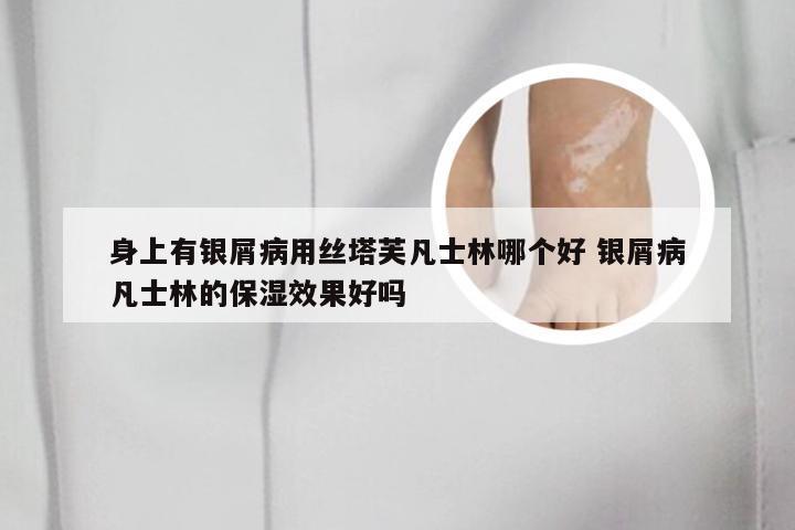 身上有银屑病用丝塔芙凡士林哪个好 银屑病凡士林的保湿效果好吗