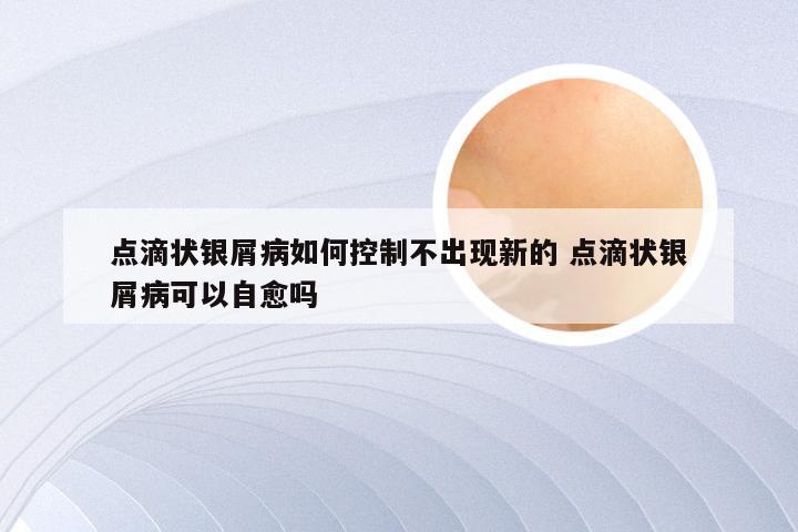 点滴状银屑病如何控制不出现新的 点滴状银屑病可以自愈吗