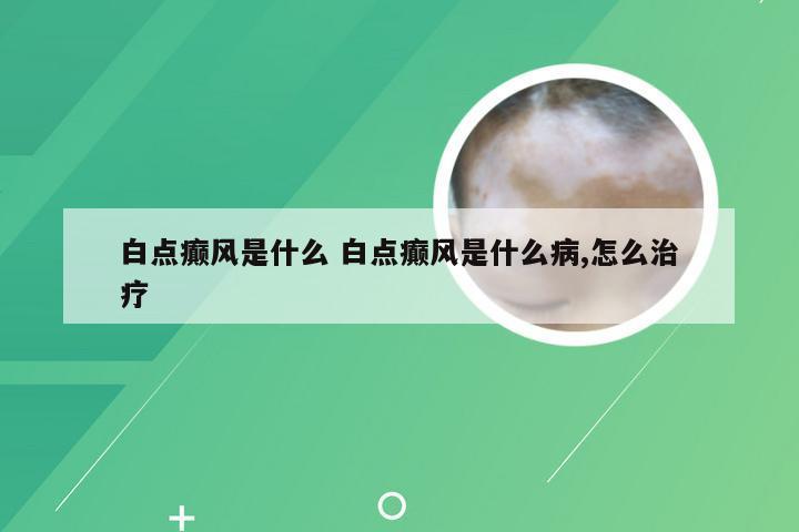 白点癫风是什么 白点癫风是什么病,怎么治疗