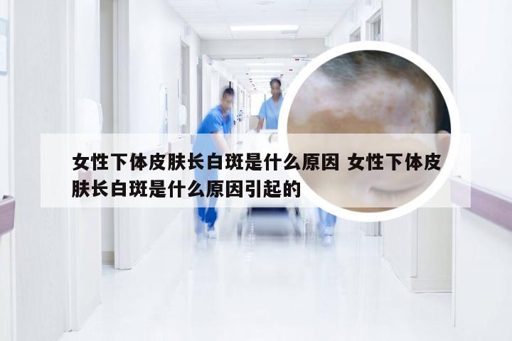 女性下体皮肤长白斑是什么原因 女性下体皮肤长白斑是什么原因引起的