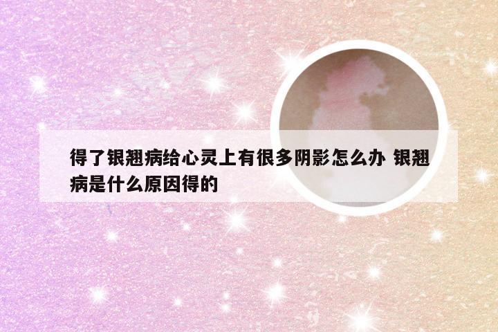 得了银翘病给心灵上有很多阴影怎么办 银翘病是什么原因得的