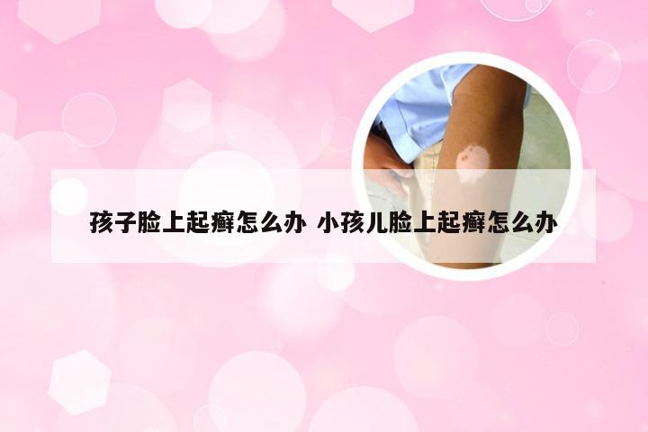 孩子脸上起癣怎么办 小孩儿脸上起癣怎么办