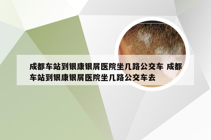 成都车站到银康银屑医院坐几路公交车 成都车站到银康银屑医院坐几路公交车去