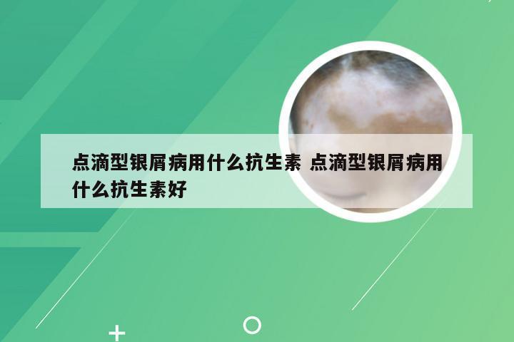 点滴型银屑病用什么抗生素 点滴型银屑病用什么抗生素好