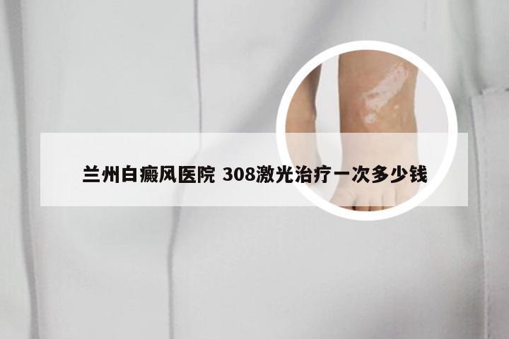 兰州白癜风医院 308激光治疗一次多少钱