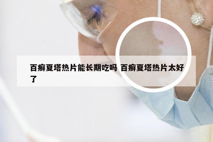 百癣夏塔热片能长期吃吗 百癣夏塔热片太好了