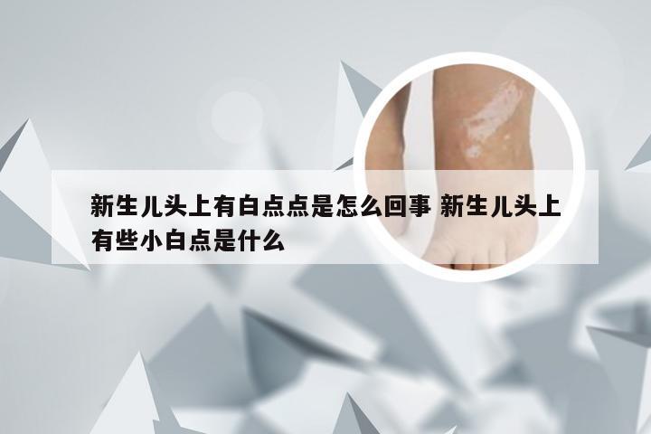 新生儿头上有白点点是怎么回事 新生儿头上有些小白点是什么