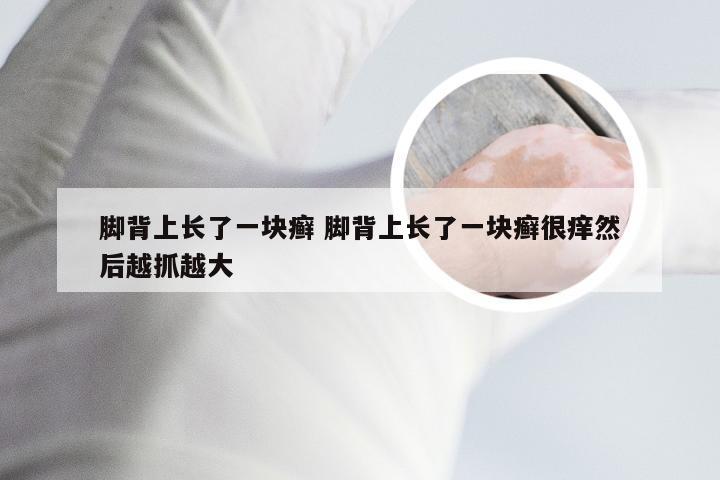 脚背上长了一块癣 脚背上长了一块癣很痒然后越抓越大