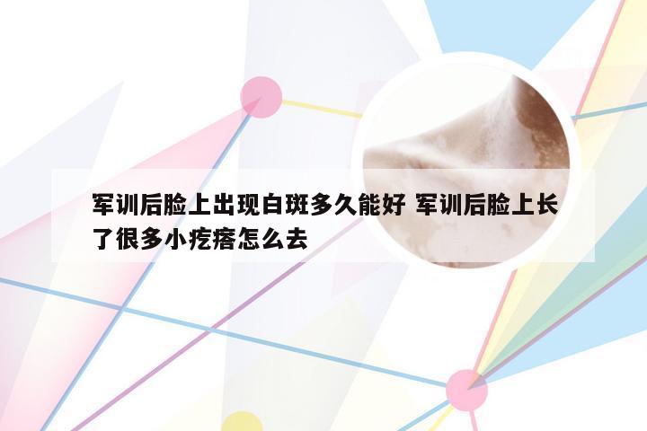 军训后脸上出现白斑多久能好 军训后脸上长了很多小疙瘩怎么去