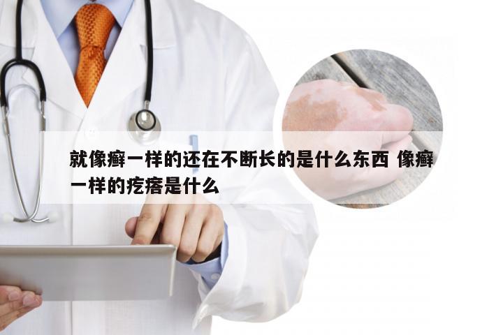 就像癣一样的还在不断长的是什么东西 像癣一样的疙瘩是什么