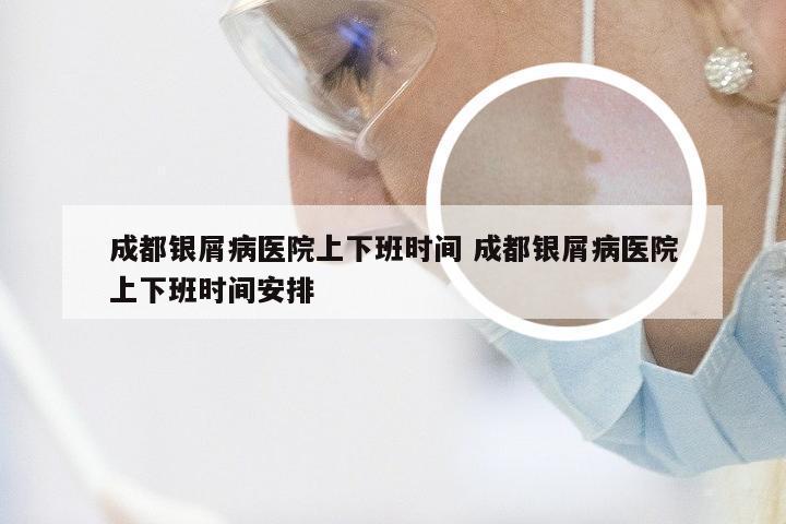 成都银屑病医院上下班时间 成都银屑病医院上下班时间安排