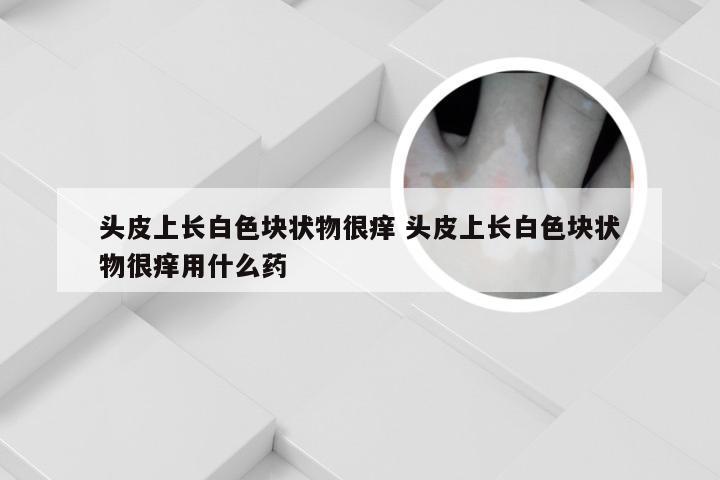 头皮上长白色块状物很痒 头皮上长白色块状物很痒用什么药