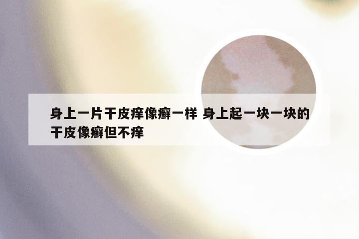 身上一片干皮痒像癣一样 身上起一块一块的干皮像癣但不痒