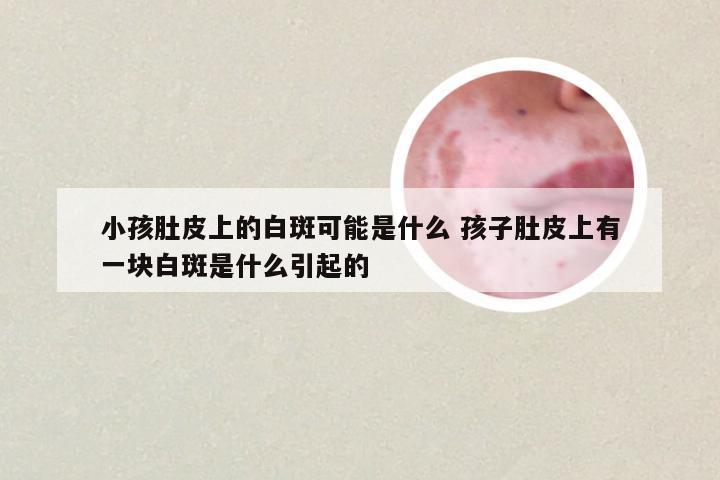 小孩肚皮上的白斑可能是什么 孩子肚皮上有一块白斑是什么引起的