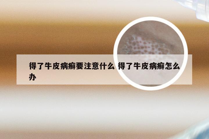 得了牛皮病癣要注意什么 得了牛皮病癣怎么办