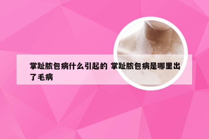 掌趾脓包病什么引起的 掌趾脓包病是哪里出了毛病