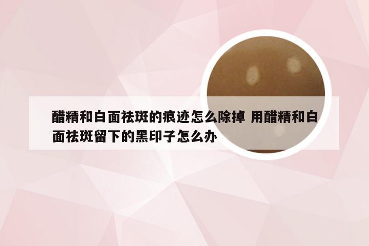 醋精和白面祛斑的痕迹怎么除掉 用醋精和白面祛斑留下的黑印子怎么办