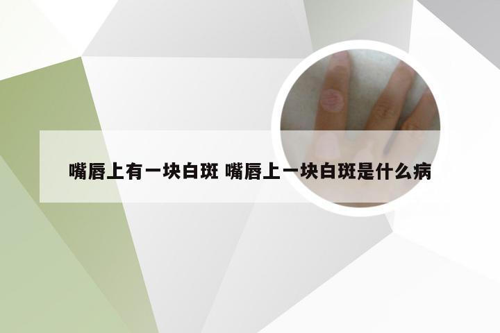 嘴唇上有一块白斑 嘴唇上一块白斑是什么病