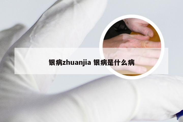银病zhuanjia 银病是什么病