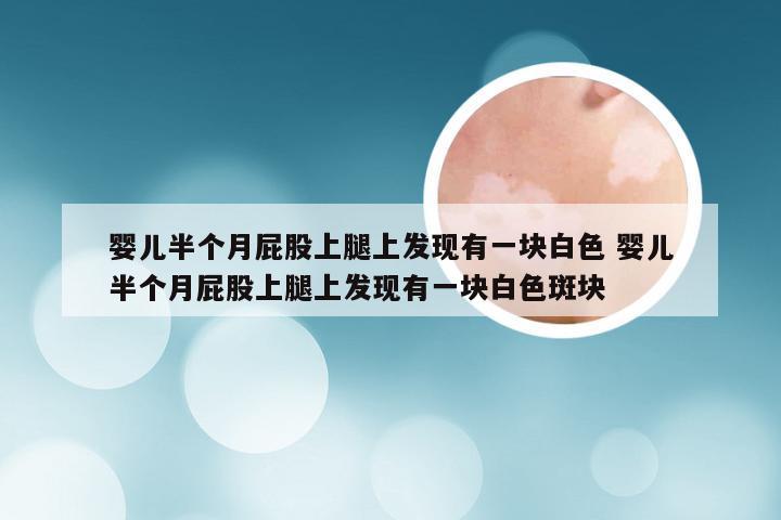 婴儿半个月屁股上腿上发现有一块白色 婴儿半个月屁股上腿上发现有一块白色斑块