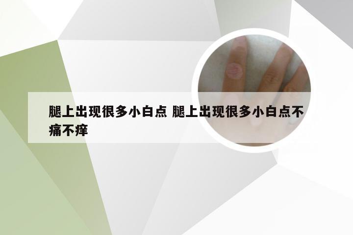 腿上出现很多小白点 腿上出现很多小白点不痛不痒