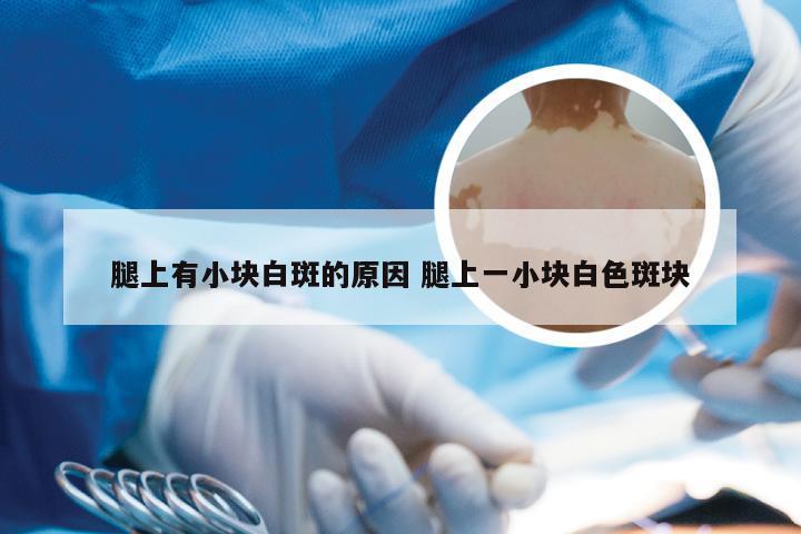 腿上有小块白斑的原因 腿上一小块白色斑块