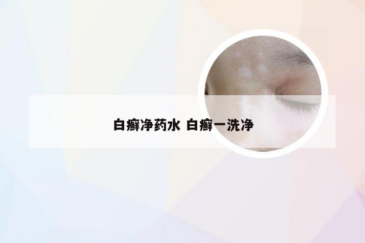 白癣净药水 白癣一洗净