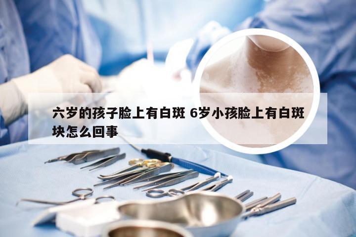 六岁的孩子脸上有白斑 6岁小孩脸上有白斑块怎么回事
