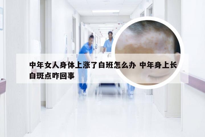 中年女人身体上涨了白班怎么办 中年身上长白斑点咋回事