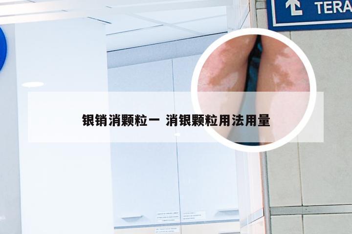 银销消颗粒一 消银颗粒用法用量