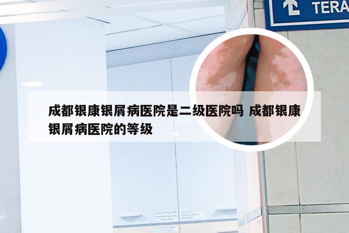 成都银康银屑病医院是二级医院吗 成都银康银屑病医院的等级