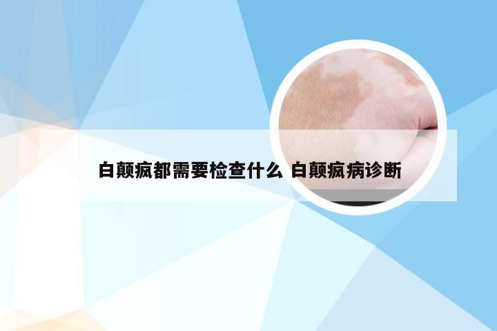 白颠疯都需要检查什么 白颠疯病诊断