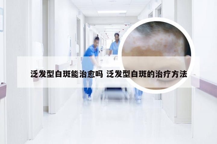 泛发型白斑能治愈吗 泛发型白斑的治疗方法