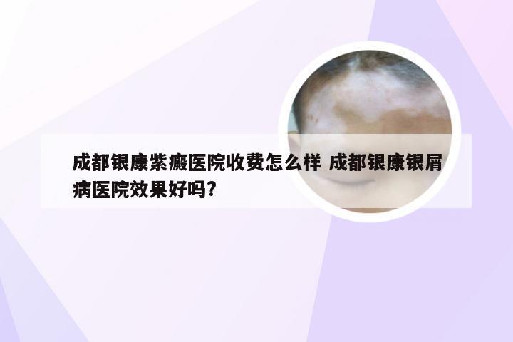 成都银康紫癜医院收费怎么样 成都银康银屑病医院效果好吗?